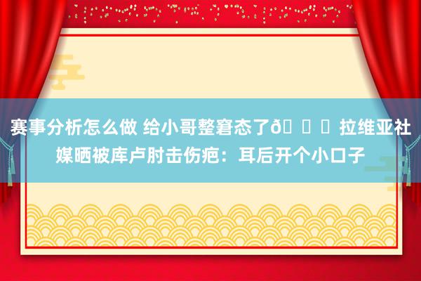 赛事分析怎么做 给小哥整窘态了😅拉维亚社媒晒被库卢肘击伤疤：耳后开个小口子